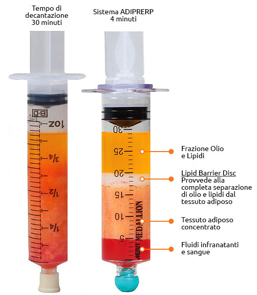 sistema-adiprerp Sistema ADIPREP