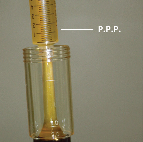 pro-prp-kit-fase6 Estrazione del plasma PPP