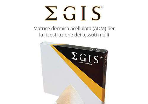 EGIS®