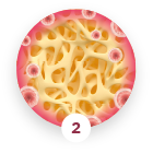 Impregnazione parziale periferica Impregnazione parziale periferica
