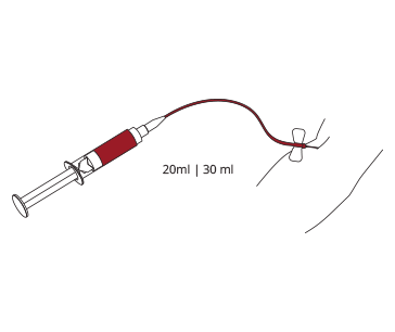 Raccolta del sangue periferico anticoagulato