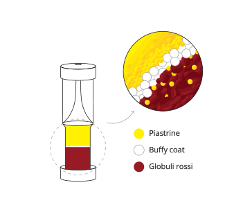 Risultati dopo la centrifugazione