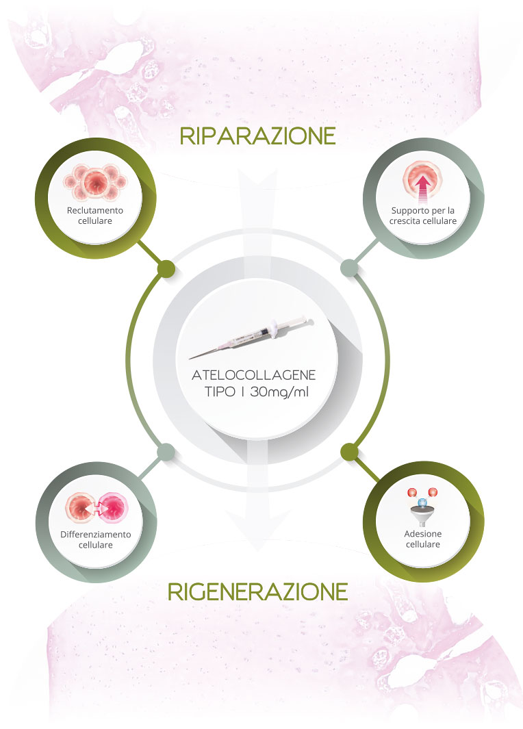 Schema riparazione rigenerazione