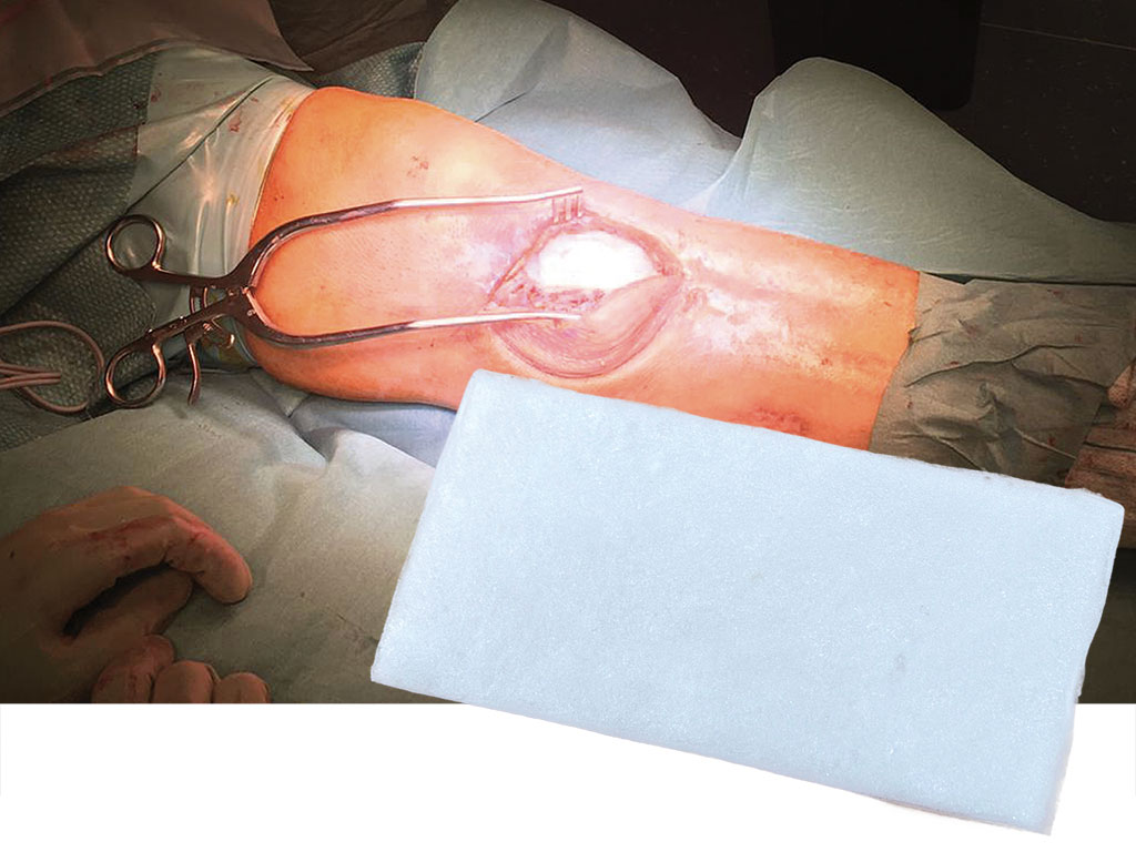 Sostituto membrana collagenica