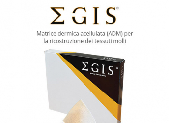 EGIS®